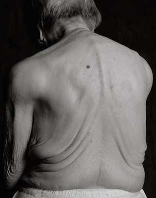 Illustration for article titled What the human body looks like at 100 years old